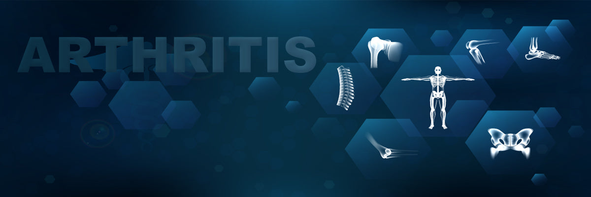 CBD Arthritis Banner - CBD Brand Review